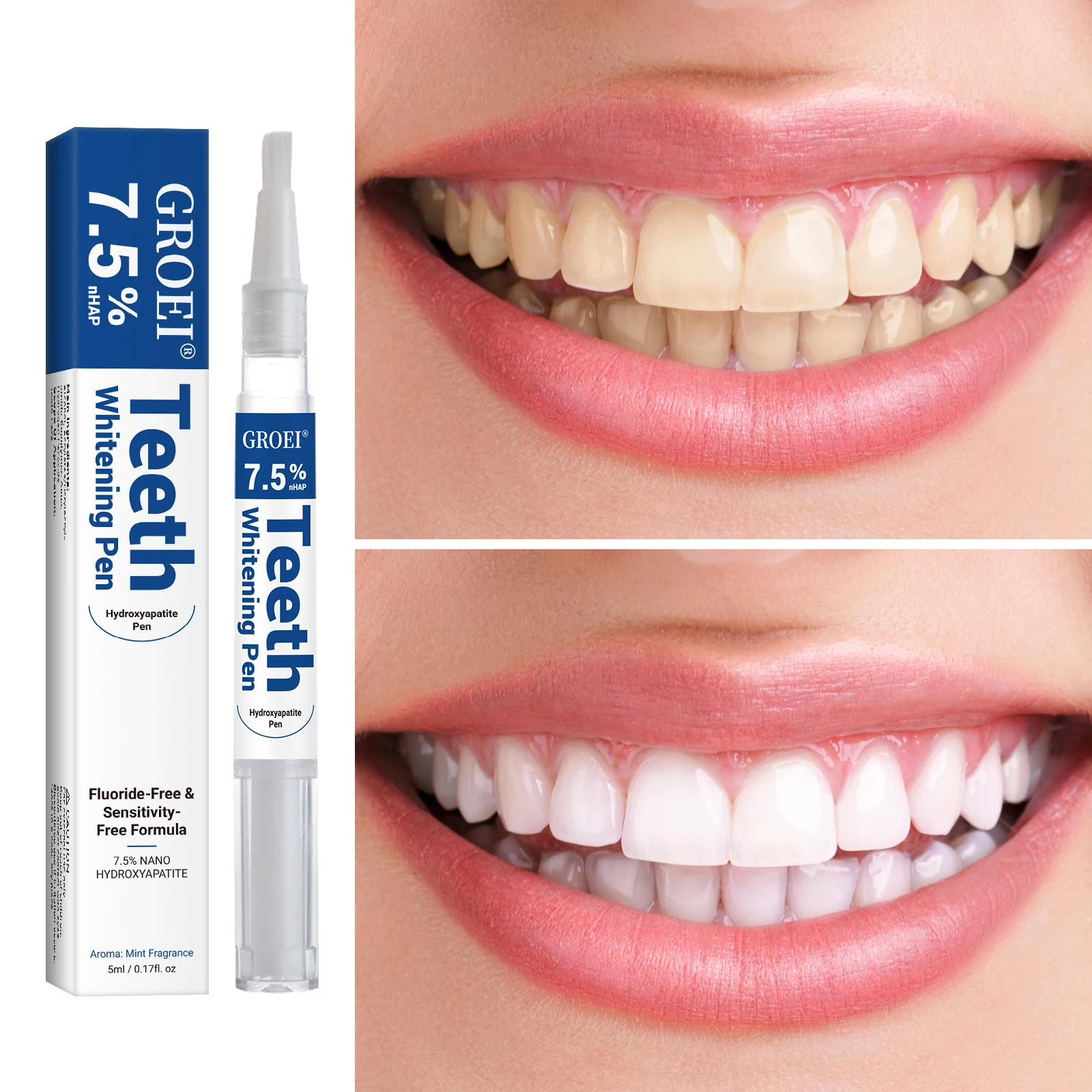 Caneta branqueadora de dente h - Teeth Whitening Near Me avaliação e preço