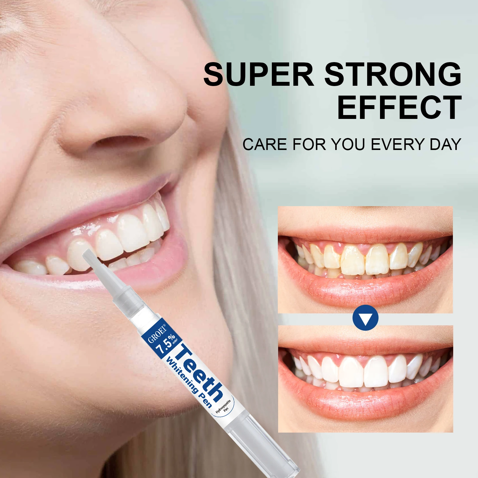 Caneta branqueadora de dente h - Teeth Whitening Near Me avaliação e preço