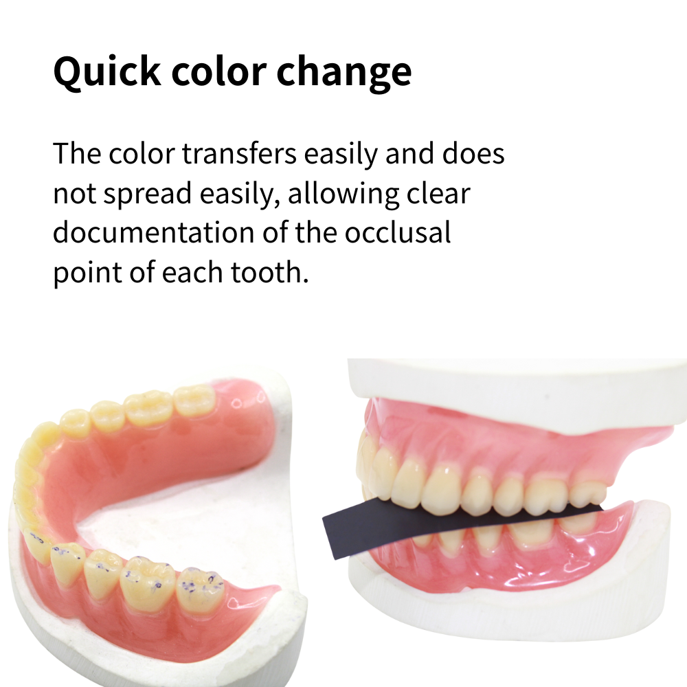 Papel de Articulação Odontológ - Teeth Whitening Lab avaliação e preço