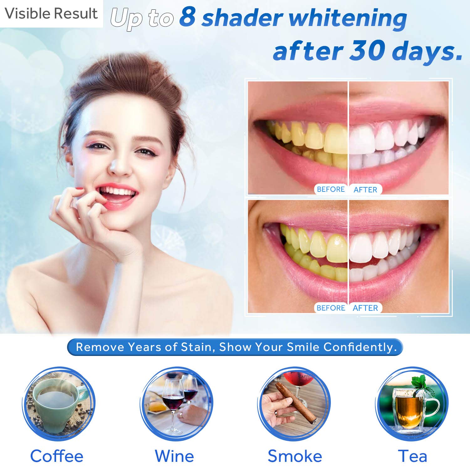 Seringa de recarga de gel para - Teeth Whitening Near Me avaliação e preço
