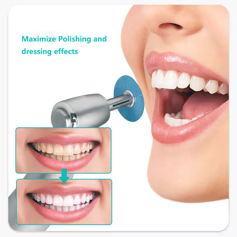 40 pçs discos de polimento den - Teeth Whitening Express avaliação e preço