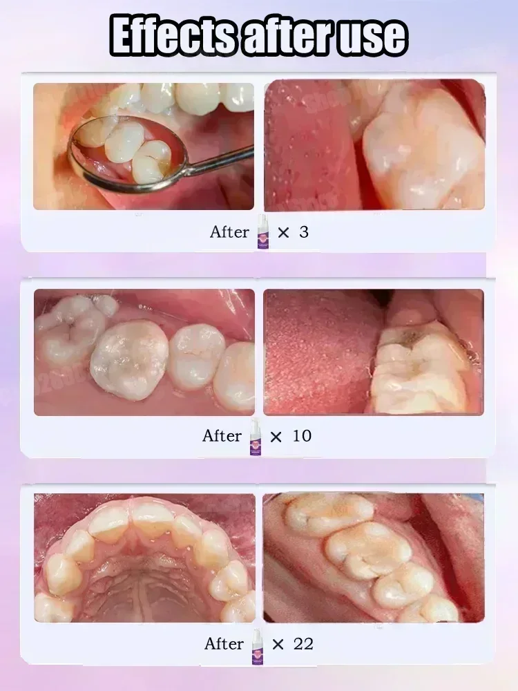 Pasta de Dente para Limpeza De - Teeth Whitening Cream avaliação e preço