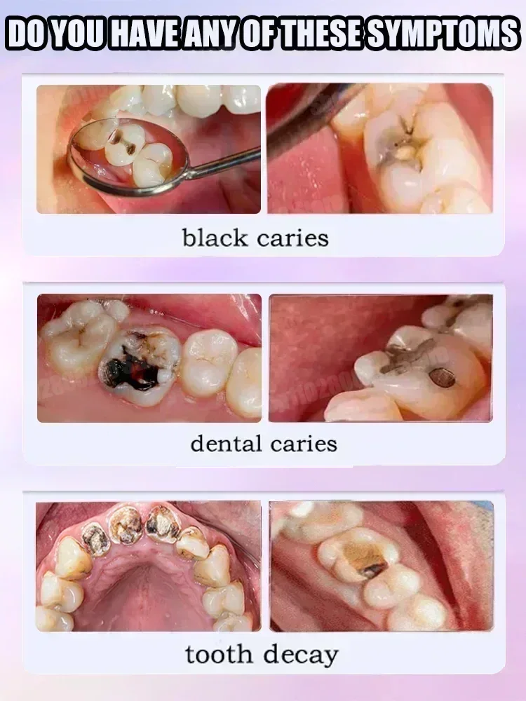 Pasta de Dente para Limpeza De - Teeth Whitening Cream avaliação e preço