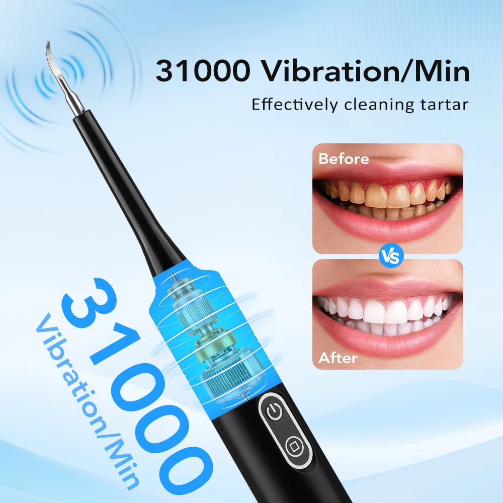Escova de Dentes Elétrica com  - Teeth Whitening Express avaliação e preço