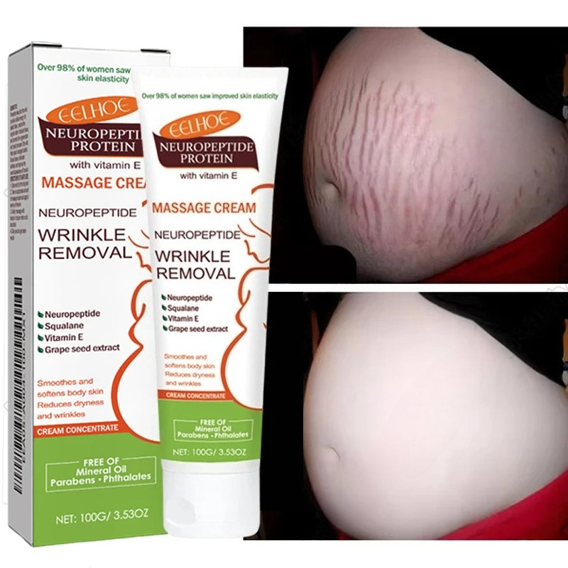 Creme para Remoção Permanente  - Teeth Whitening Pregnancy avaliação e preço