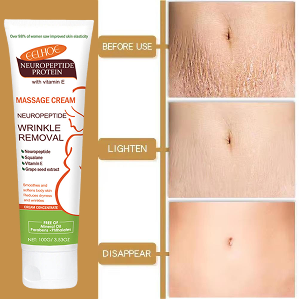 Creme para Remoção Permanente  - Teeth Whitening Pregnancy avaliação e preço